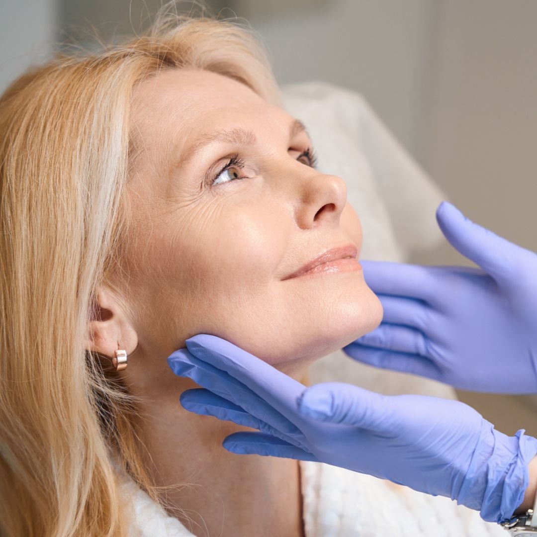 facelift surgery london