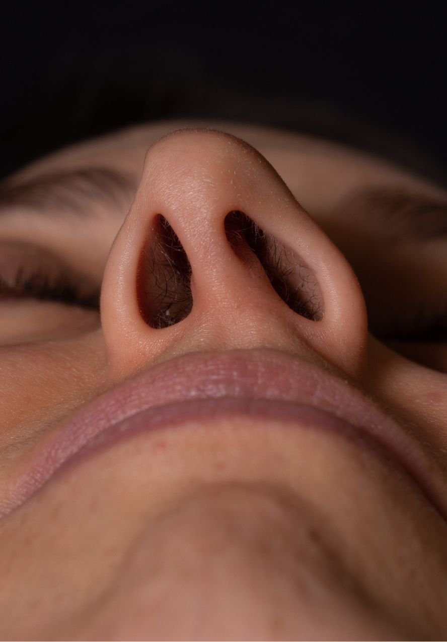 deviated noses