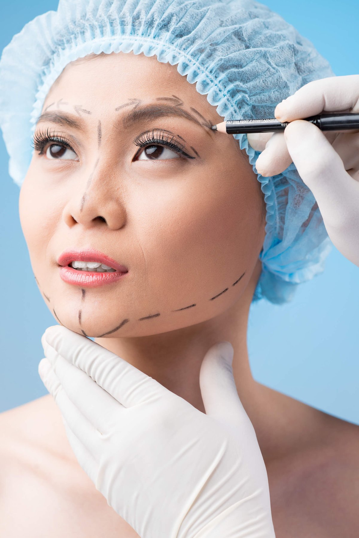what-is-chin-implant